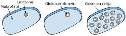 Gaucherova bolest - Šta je Gaucherova bolest?